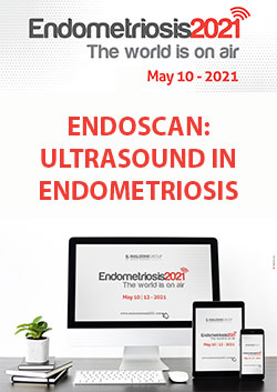 Course Image ENDOSCAN: ULTRASOUND IN ENDOMETRIOSIS